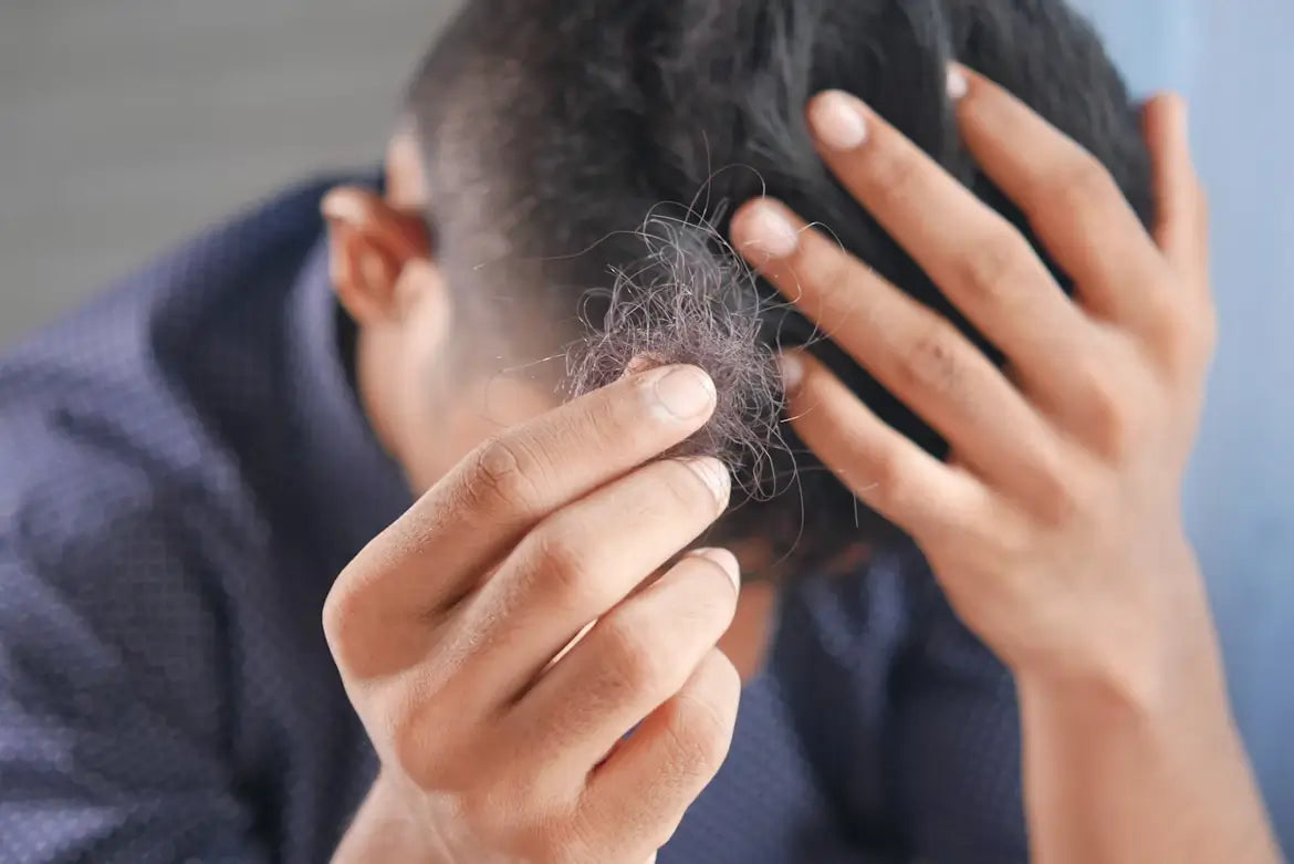 Man holding clump of fallen hair while touching his head, showing visible concern about hair loss.